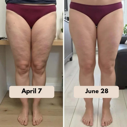 SlimCore™ Anti-Cellulite Leggings — visible results in 14 days