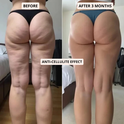 SlimCore™ Anti-Cellulite Leggings — visible results in 14 days