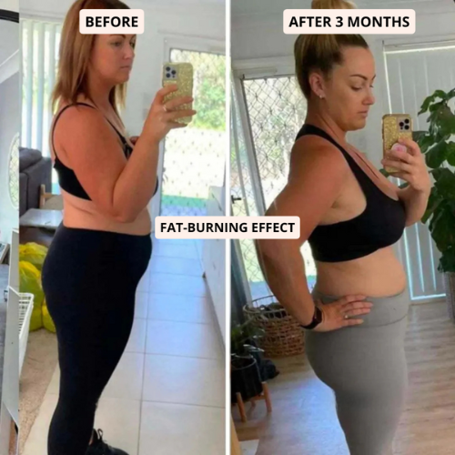 SlimCore™ Anti-Cellulite Leggings — visible results in 14 days