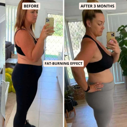 SlimCore™ Anti-Cellulite Leggings — visible results in 14 days