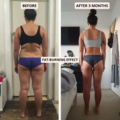 SlimCore™ Anti-Cellulite Leggings — visible results in 14 days